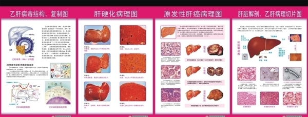 肝病科解剖图