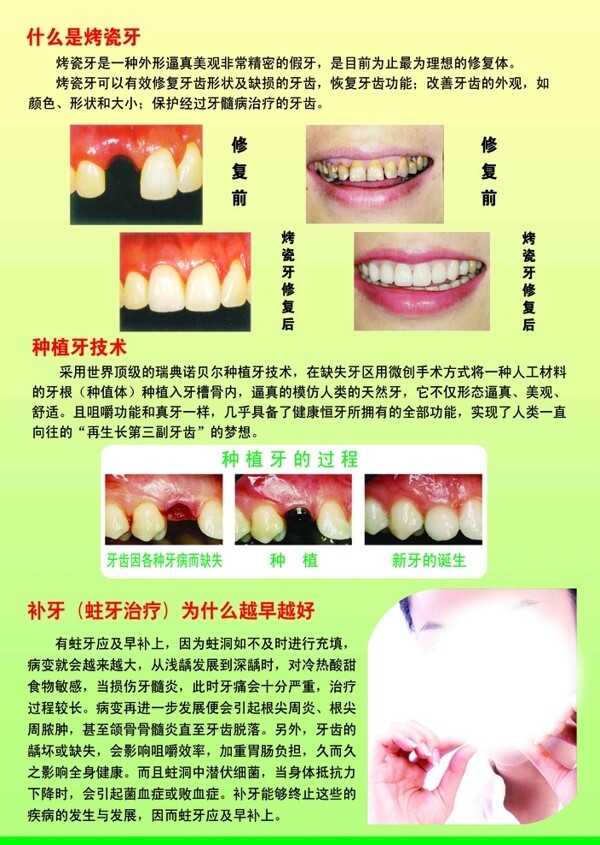 牙科宣傳單海報圖片
