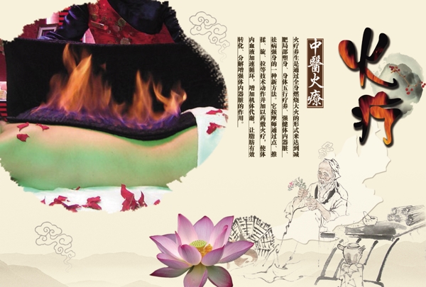 火療宣傳展板