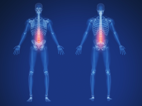 人体脊椎X光图片
