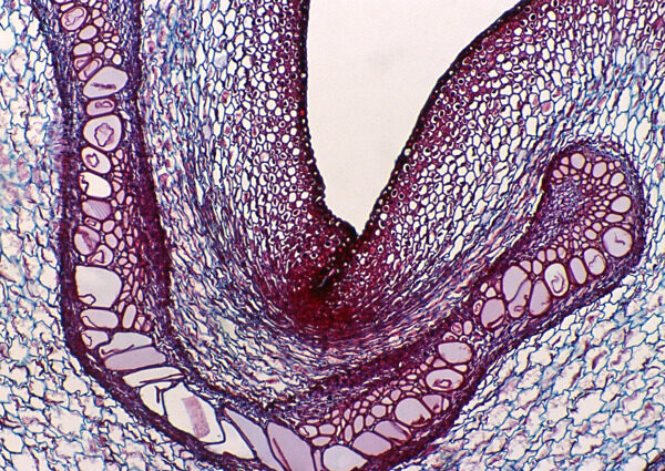网状紫色细胞