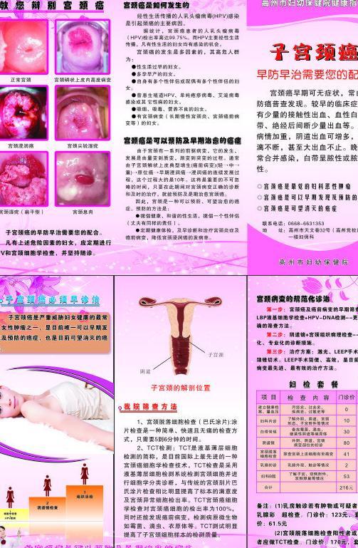 子宫颈癌广告图片