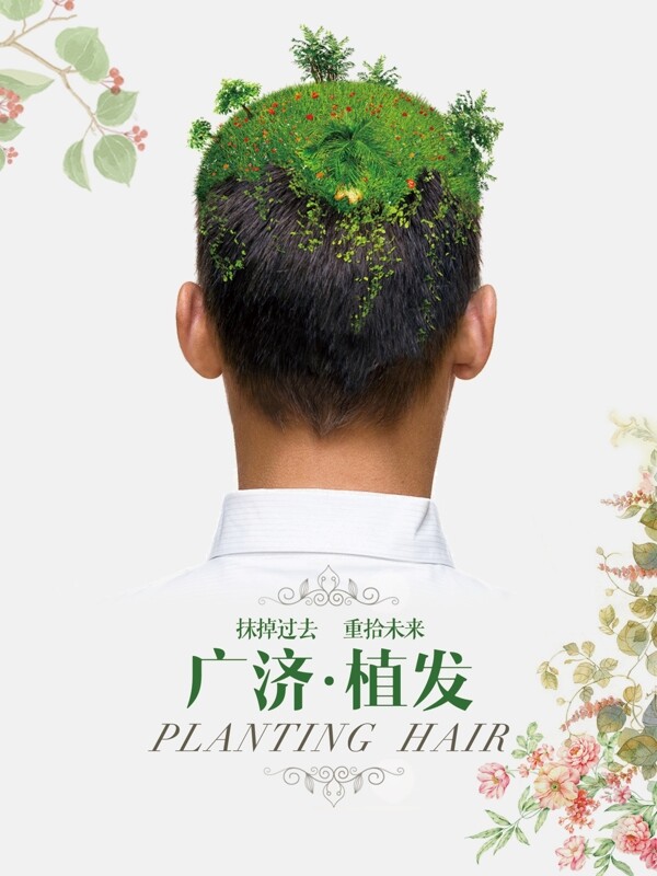 植发