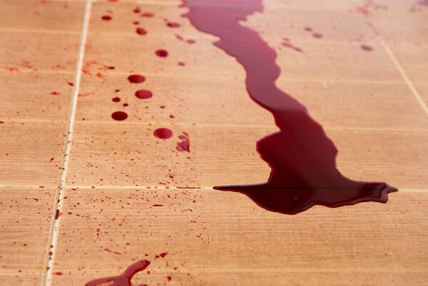 地板上的血图片