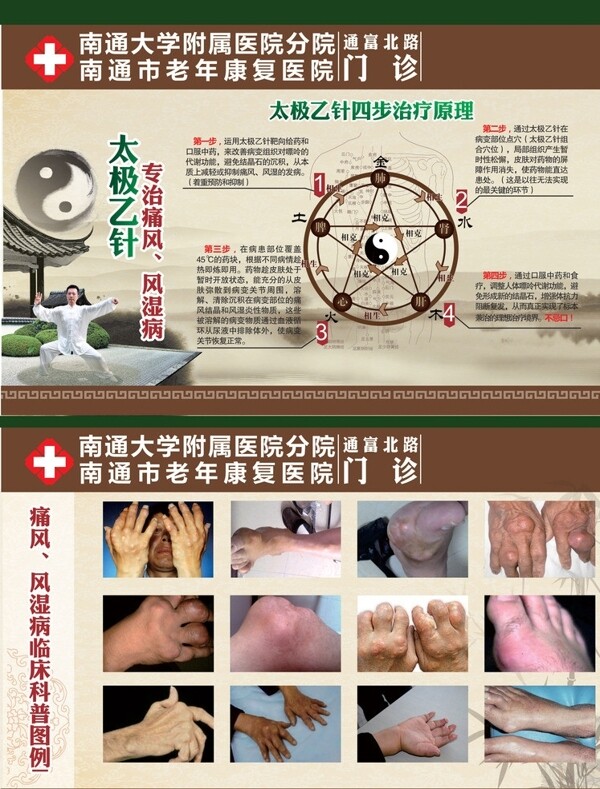 中医疗法图片