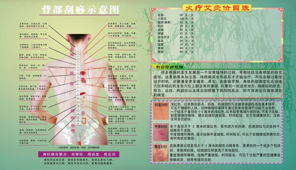 刮痧展板图片