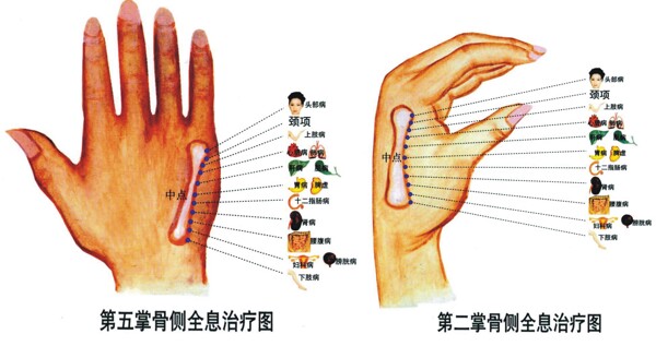 手掌反射区全息治疗图图片