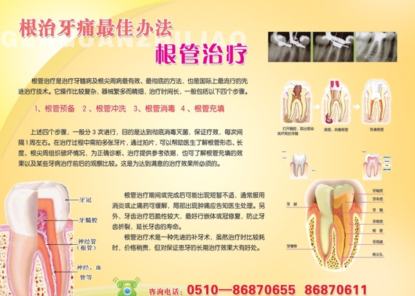 牙痛治疗根管治疗图片
